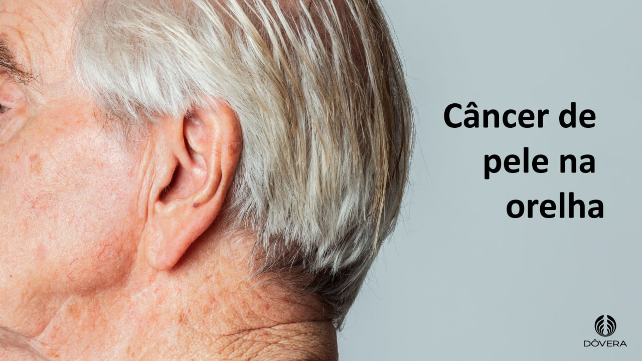 câncer de pele na orelha como suspeitar?