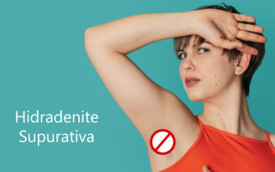 Hidradenite Supurativa