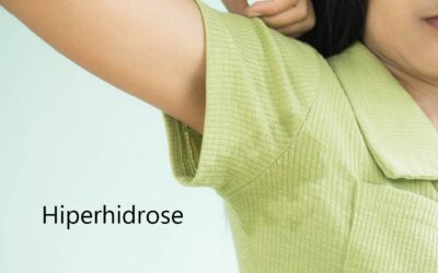 Hiperhidrose: compreendendo e tratando o suor em excesso